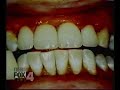 Signature Smiles on FOX 4 Part 2 Signature Smiles on FOX 4 Part 2