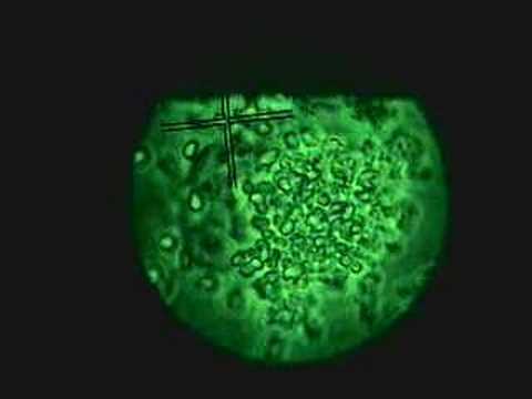 Toxoplasma gondii emerging out from ...