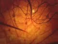 Neuron Network