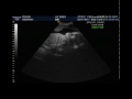3D Ultrasound Baby Judah 29 weeks