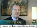 ‪Hair Restoration - Dr. Edmond Griffin in Delivering Natural Looking Hair Transplant Results‬&rlm; - YouTube