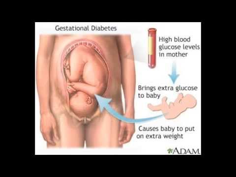 how to control gdm during pregnancy