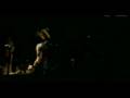 Trashlight Vision Allergic To You Video and Lyrics