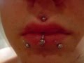 Medusa Piercing | Swelling Diary