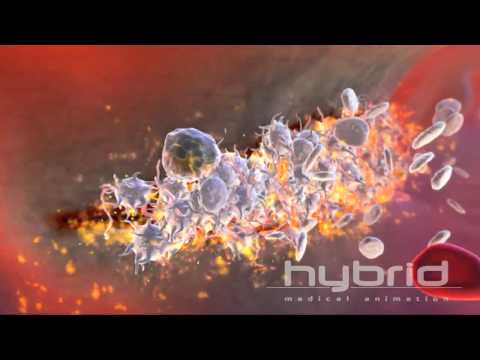 An Introduction to Thrombosis