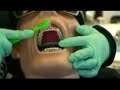 Brushing your Braces