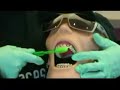 Brushing your Braces