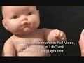 dr  lile pba partial birth abortion demo pro life