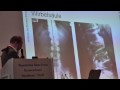 SchmerzNetzOrgTag4DrSiegfriedZineckerNeuraltherapieAkupunkturYamamotoFilmBikeGALAcomtvSaturnNbg.mpg