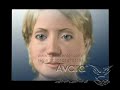 جراحة التجميل في مصر تجميل الجفن