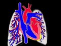 heart biopsy