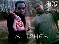 B-res Stitches