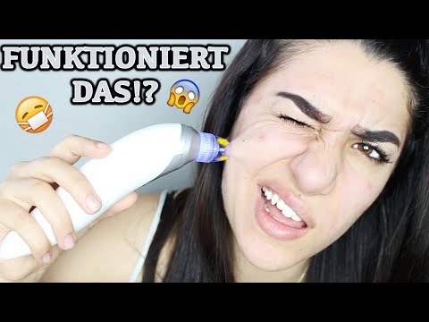 MITESSER SAUGER! 😷 GEHT DAS? 😱 - Ebru Acikyol