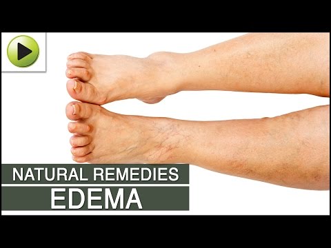 how to relieve fluid retention in feet