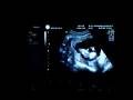 Echo12w4d