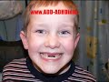 ADHD Help Video #6  ADHD THERAPY
