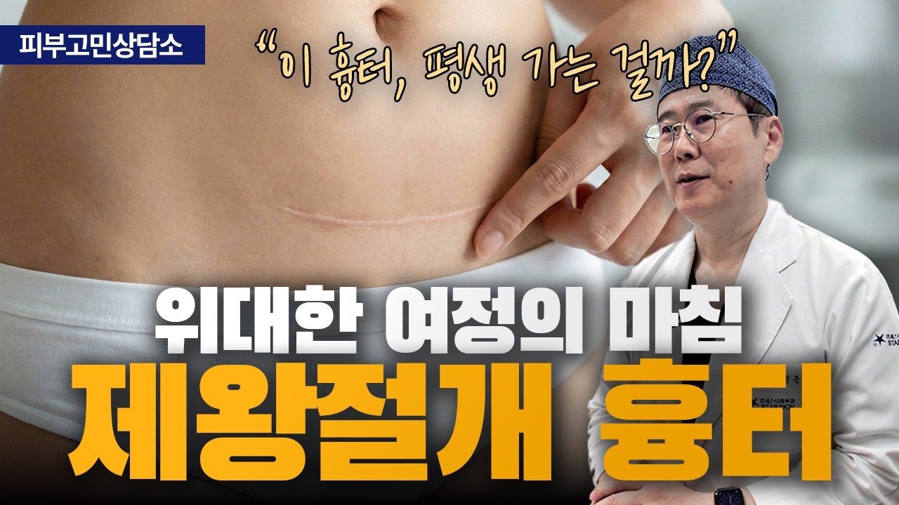 연세스타피부과 TV