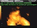 GRAVIMAGEM 103 (ULTRA-SOM GRAVIDEZ 3D 4D 28 SEMANAS) GRAVIMAGEM 103 (ULTRA-SOM GRAVIDEZ 3D 4D 28 SEMANAS)