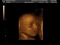 Ecografia 4D de nuestro bebe Ecografia 4D de nuestro bebe