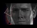 NFS AV Wars - Blackbox