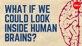 What if we could look inside Human Brains?