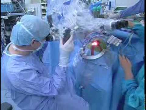 Podcast: Temporal Lobectomy Epilepsy ...