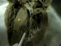 internal features of the heart internal features of the heart