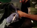 RFID Implant - Sterilization and Marking