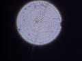 Bacteria In Urine Bacteria In Urine