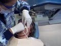 Placing Ty's Braces At Glendale CA Orthodontist