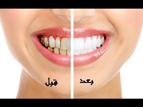 نيك في الفم