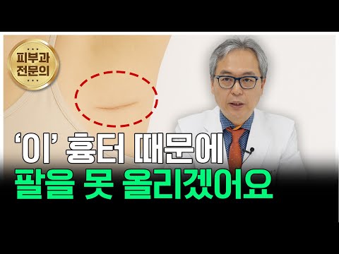 연세스타피부과 TV