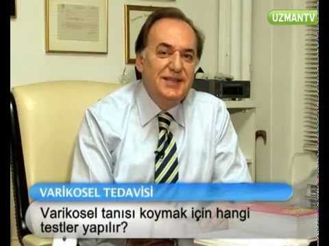 Varikosel 0 Varikosel