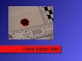 Vloeitest met bloed bij NFI