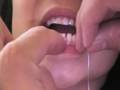 videos de Wrong way to pull out tooth