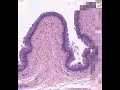 Shotgun Histology Bladder