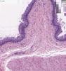 Shotgun Histology Bladder