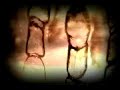 Scorn Video Fumble