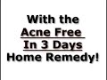 Acne Treatment Acne Treatment
