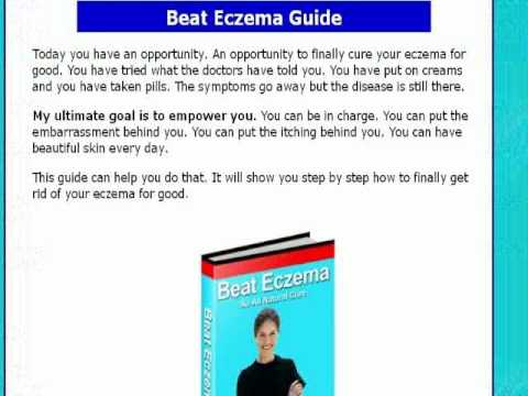 how to relieve eczema around eyes