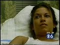 Botox tx for sweating (Hyperhidrosis)-Williams Ctr Botox tx for sweating (Hyperhidrosis)-Williams Ctr