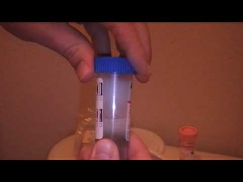 how to collect stool for c diff test