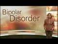 Bipolar Overview