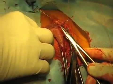 labia -