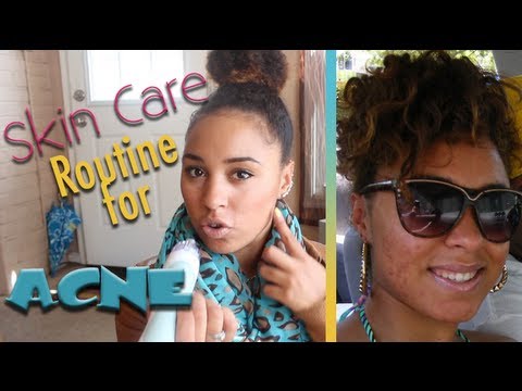 how to apply clindamycin phosphate