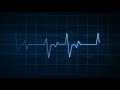 Ae Digital Electrocardiogram