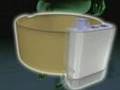 WalkAide treats  Foot Drop using Myo-Orthotics Technology