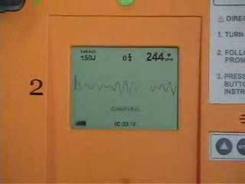 CU-ER1 AED (Automated External Defibrillator) 