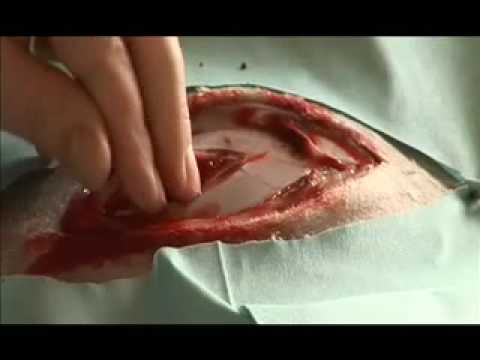 how to perform a c section on a goat