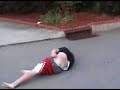 horrific longboard crash, suffers cracked clavicle, separated shoulder, and concussion horrific longboard crash, suffers cracked clavicle, separated shoulder, and concussion